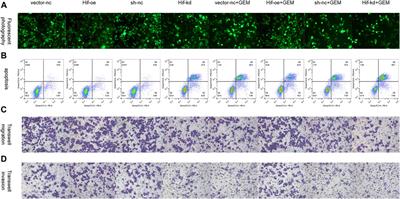 Thymoquinone affects the gemcitabine sensitivity of pancreatic cancer by regulating collagen via hypoxia inducible factor-1α